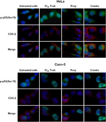 Cervical cancer benefits from trabectedin combination with the β-blocker propranolol: in vitro and ex vivo evaluations in patient-derived organoids